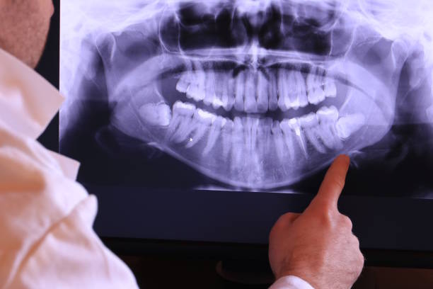 Best Emergency Root Canal Treatment in Lake Lure, NC